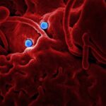 Can the world achieve elimination of viral hepatitis by 2030?