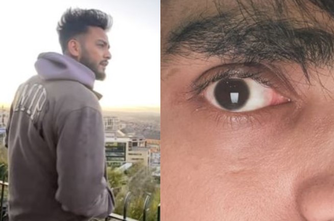 Elvish Yadav